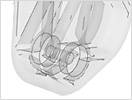 Autodesk Moldflow Insight: Specialized Molding Processes - Gas-assisted Injection Molding
